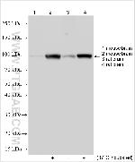SMEK1 Antibody in Western Blot (WB)