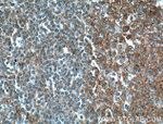 Il2 Antibody in Immunohistochemistry (Paraffin) (IHC (P))