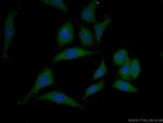 Mcp1 Antibody in Immunocytochemistry (ICC/IF)