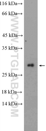 MOSPD3 Antibody in Western Blot (WB)