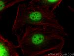 ZNF189 Antibody in Immunocytochemistry (ICC/IF)