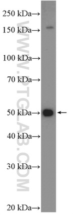 NCAPH2 Antibody in Western Blot (WB)