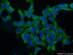 EIF3A Antibody in Immunocytochemistry (ICC/IF)