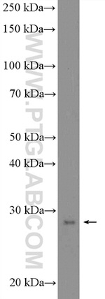 SNAI1 Antibody in Western Blot (WB)