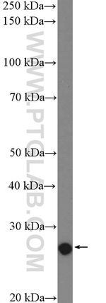 SNAI1 Antibody in Western Blot (WB)