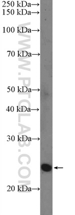 SNAI1 Antibody in Western Blot (WB)