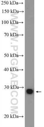 SNAI1 Antibody in Western Blot (WB)