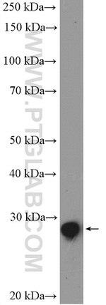 SNAI1 Antibody in Western Blot (WB)