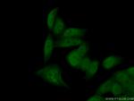 SNAI1 Antibody in Immunocytochemistry (ICC/IF)