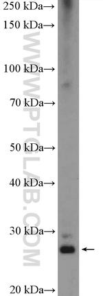 SNAI1 Antibody in Western Blot (WB)