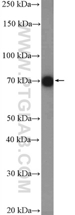 DRP1 (N-terminal) Antibody in Western Blot (WB)