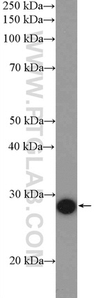 C15orf23 Antibody in Western Blot (WB)