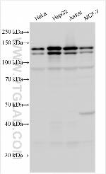 SAPS2 Antibody in Western Blot (WB)