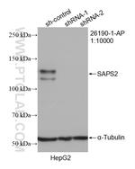 SAPS2 Antibody in Western Blot (WB)
