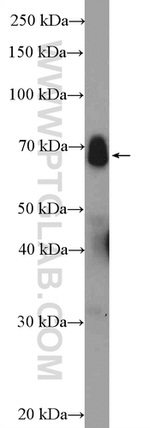c-FOS Antibody in Western Blot (WB)