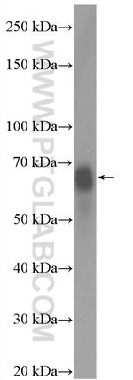 c-FOS Antibody in Western Blot (WB)