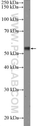 RPS6KB2 Antibody in Western Blot (WB)