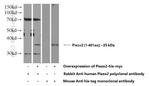 Piezo2 Antibody in Western Blot (WB)