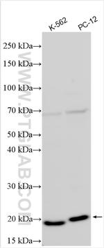 SOCS2 Antibody in Western Blot (WB)