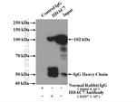 HDAC7 Antibody in Immunoprecipitation (IP)
