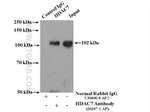 HDAC7 Antibody in Immunoprecipitation (IP)