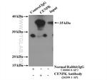 CENPK Antibody in Immunoprecipitation (IP)
