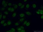 C11orf30 Antibody in Immunocytochemistry (ICC/IF)