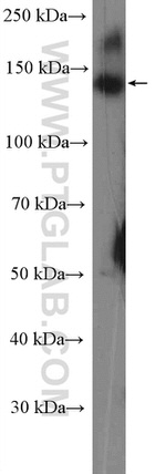 C11orf30 Antibody in Western Blot (WB)