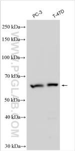 DBF4B Antibody in Western Blot (WB)