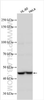 ZNF202 Antibody in Western Blot (WB)