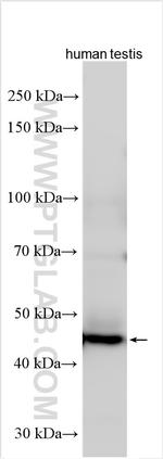 ZNF202 Antibody in Western Blot (WB)