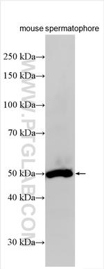 ZNF202 Antibody in Western Blot (WB)