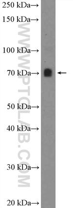 PATZ1 Antibody in Western Blot (WB)