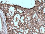 SCGB3A2 Antibody in Immunohistochemistry (Paraffin) (IHC (P))