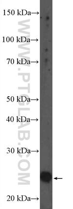 FAHD1 Antibody in Western Blot (WB)