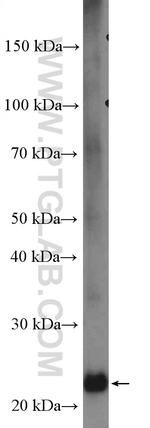 COMMD3 Antibody in Western Blot (WB)