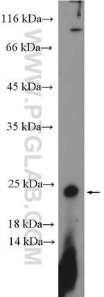 COMMD3 Antibody in Western Blot (WB)