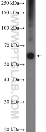 ZC3H15 Antibody in Western Blot (WB)