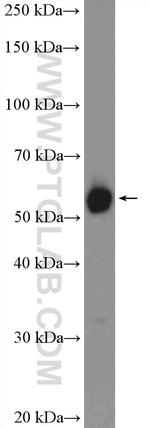 ZC3H15 Antibody in Western Blot (WB)