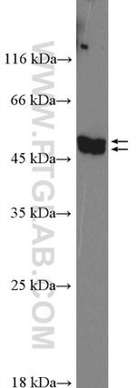FAM126A Antibody in Western Blot (WB)