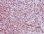 GATA-3 (Breast and Urothelial Marker) Antibody in Immunohistochemistry (Paraffin) (IHC (P))