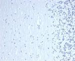 GATA-3 (Center) (Breast and Urothelial Marker) Monoclonal Antibody (GATA3/6664)