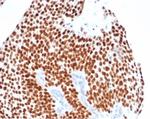 GATA-3 (Breast and Urothelial Marker) Antibody in Immunohistochemistry (Paraffin) (IHC (P))