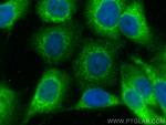CHM Antibody in Immunocytochemistry (ICC/IF)