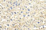 CHM Antibody in Immunohistochemistry (Paraffin) (IHC (P))