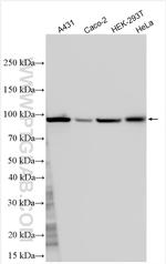 CHM Antibody in Western Blot (WB)