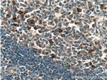 CLEC16A Antibody in Immunohistochemistry (Paraffin) (IHC (P))