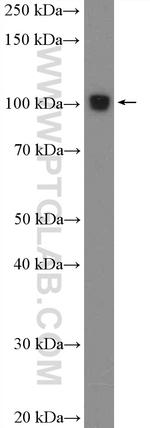 CLEC16A Antibody in Western Blot (WB)