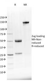 NKX2.8 Antibody in SDS-PAGE (SDS-PAGE)