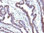 EMI1 (Early Mitotic Inhibitor-1) Monoclonal Antibody (EMI1/1176)